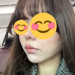 REVI CLINIC銀座院 REVI CLINIC銀座院 口コミ