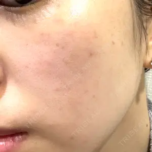 CIEL SKIN CLINIC（シエルスキンクリニック）口コミ