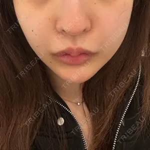 口コミ