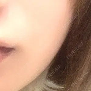 TCB東京中央美容外科 TCB東京中央美容外科 名古屋駅前院口コミ