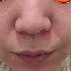 口コミ