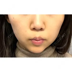 口コミ