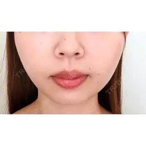 EMMO FACE CLINIC EMMO FACE CLINIC 東京三田院口コミ