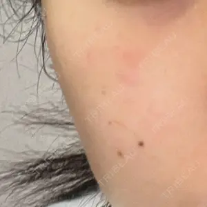 トラスト美容クリニック トラスト美容クリニック 銀座院口コミ