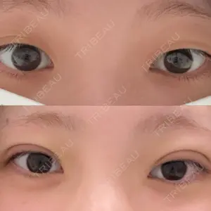 ルラ美容クリニック ルラ美容クリニック 札幌本院口コミ