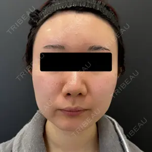 BLINC CLINIC （ブリンク クリニック）口コミ