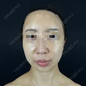 藤・ナチュレ美容クリニック 藤・ナチュレ美容クリニック 銀座院口コミ
