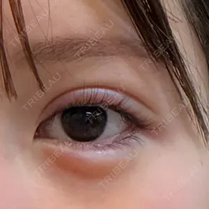 口コミ