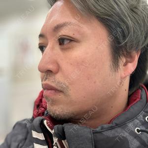 エースクリニック エースクリニック 大阪梅田HEPナビオ院口コミ