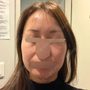 ソウルアイ美容外科医院口コミ