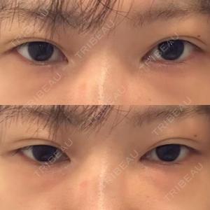 TCB東京中央美容外科 TCB東京中央美容外科 銀座有楽町院口コミ