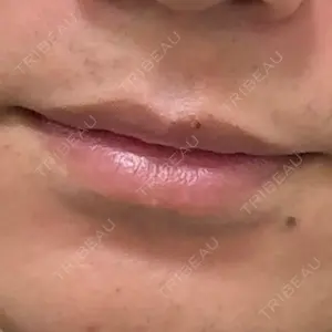 口コミ
