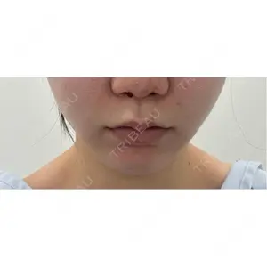 新宿ラクル美容外科クリニック 新宿ラクル美容外科クリニック 新宿院口コミ