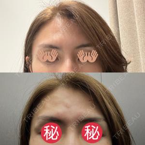 プロクリニック PRO CLINIC プロクリニック 銀座院口コミ