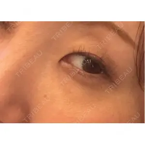 エルムクリニック 美容皮膚科エルムクリニック 岡山院口コミ