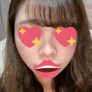 ビーザニュー美容整形外科（旧コノピ美容整形外科）口コミ
