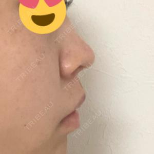 ビーザニュー美容整形外科（旧コノピ美容整形外科）口コミ
