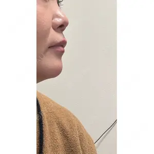HAAB CLINIC HAAB×DREAM BEAUTY CLINIC 大阪梅田院口コミ