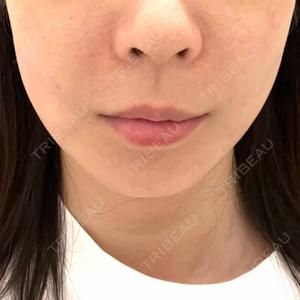 湘南美容クリニック 湘南美容クリニック 名古屋栄院口コミ