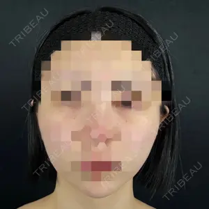 藤・ナチュレ美容クリニック 藤・ナチュレ美容クリニック 銀座院口コミ