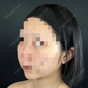 藤・ナチュレ美容クリニック 藤・ナチュレ美容クリニック 銀座院口コミ