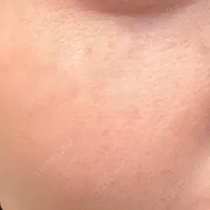 おおたかの森ビューティークリニック おおたかの森ビューティークリニック口コミ