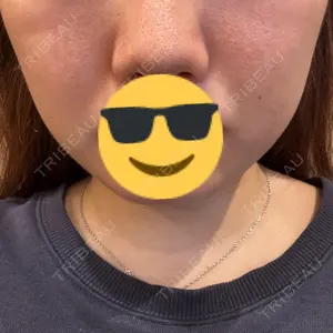 口コミ