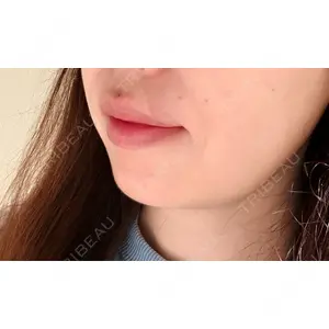 HAAB CLINIC HAAB×DREAM BEAUTY CLINIC 東京本院口コミ