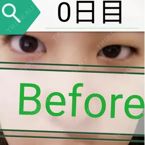 口コミ