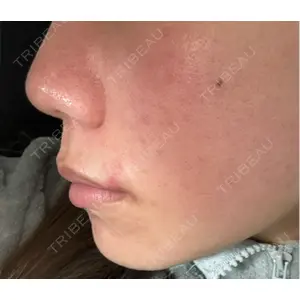 HAAB CLINIC HAAB BEAUTY CLINIC 名古屋院口コミ