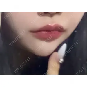 口コミ