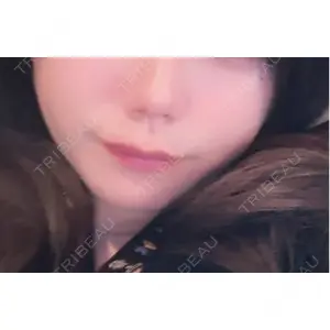 HAAB CLINIC HAAB BEAUTY CLINIC 名古屋院口コミ