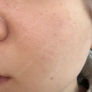 ルラ美容クリニック ルラ美容クリニック 新潟院口コミ