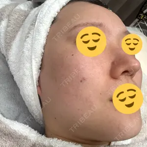 BISIN GINZA CLINIC口コミ