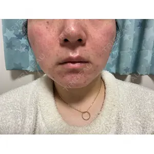 ルラ美容クリニック ルラ美容クリニック 岐阜院口コミ