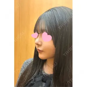 LUHO（ルホ）美容外科口コミ