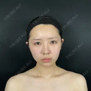 藤・ナチュレ美容クリニック 藤・ナチュレ美容クリニック 銀座院口コミ
