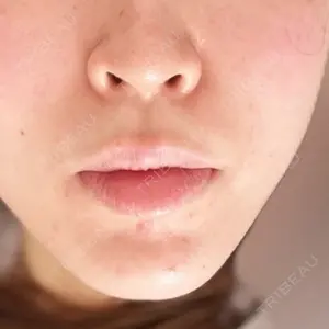 口コミ