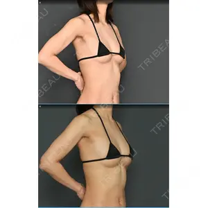Lipo Clinic omotesando口コミ