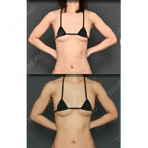 Lipo Clinic omotesando口コミ