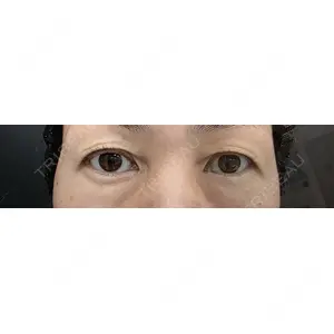口コミ
