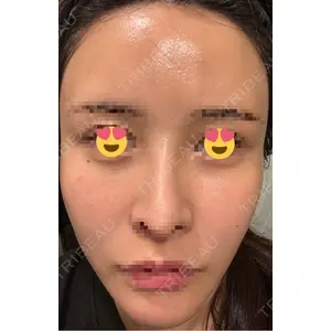 APスキンクリニック銀座口コミ