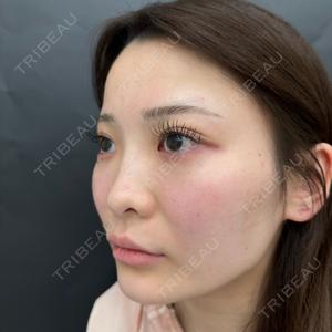 ルラ美容クリニック ルラ美容クリニック 町田院口コミ