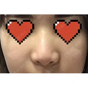 口コミ