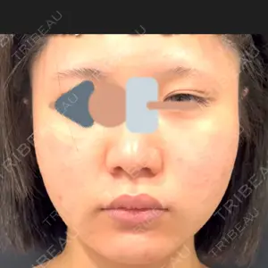 LEX BEAUTY CLINIC LEX BEAUTY CLINIC口コミ