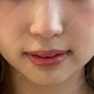 口コミ