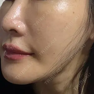 SUNMELIA SKIN CLINIC SUNMELIA SKIN CLINIC口コミ