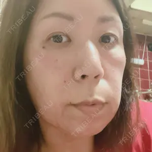 ルラ美容クリニック ルラ美容クリニック 札幌本院口コミ