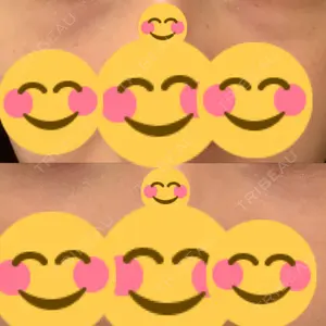 東京イセアクリニック口コミ