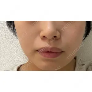 おおかみ美容のクリニック おおかみ美容のクリニック 新宿院口コミ